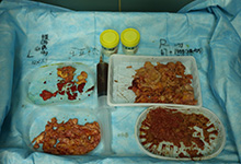 市面常见的丰体针有哪些牌子